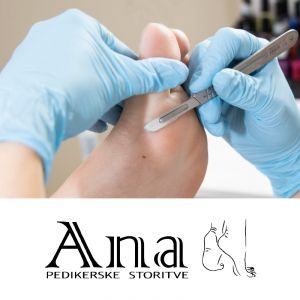 Medicinska pedikura za 1 osebo, Pedikerske storitve Ana, Pivka (Vrednostni bon, izvajalec storitev: ANA BOLE s.p.)
